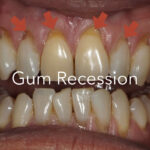 What Is a Periodontist? When to See a Gum Specialist