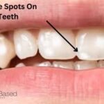 Understanding Lateral Periodontal Cysts: Causes, Diagnosis, and Treatment Options