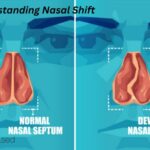 Why Sinus Infections Can Cause Jaw Pain: A Detailed Guide