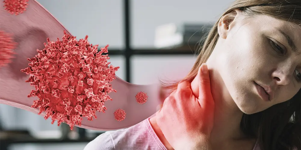 Swollen glands means a tiny, bean-shaped part of your body’s immune system. When individuals say “swollen glands,” they generally mean swollen lymph nodes.