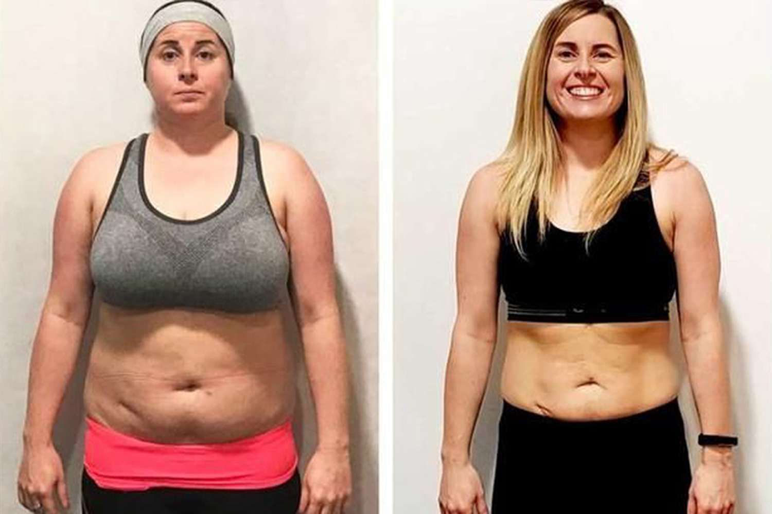 PCOS and Weight Gain